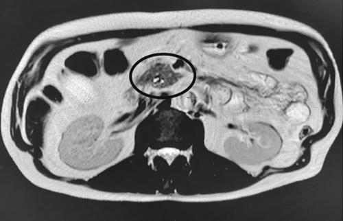 Изображение на обложке